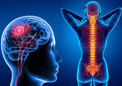 Neurochirurgie